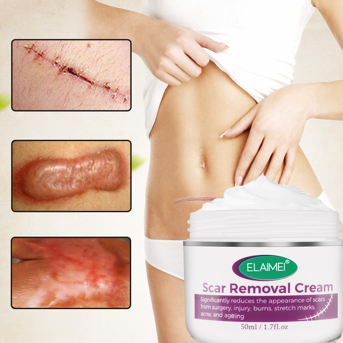 Skin Rebound Scarless Cream Scar Removal Cream Face Cream For Face Acne Scar Stretch Marks Skin Repair Face Cream Skin Rebound Scarless Cream Scar Removal Cream Face Cream For Face Acne Scar Stretch Marks Skin Repair Face Cream